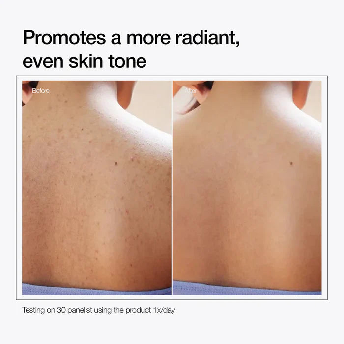 Urapra Glycolic Acid 3%