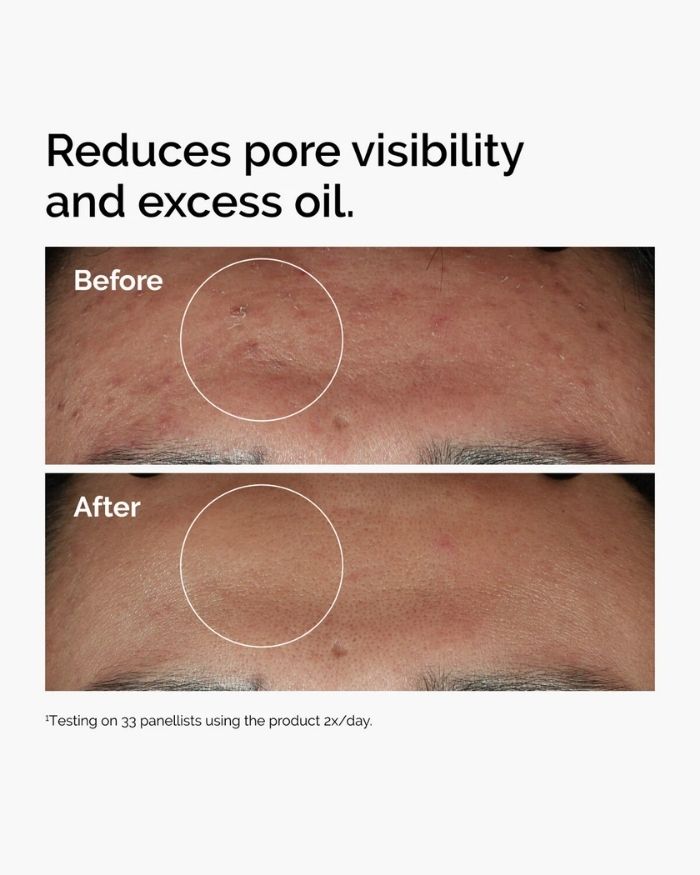 The Ordinary Niacinamide 10% + Zinc 1 % - 30ml